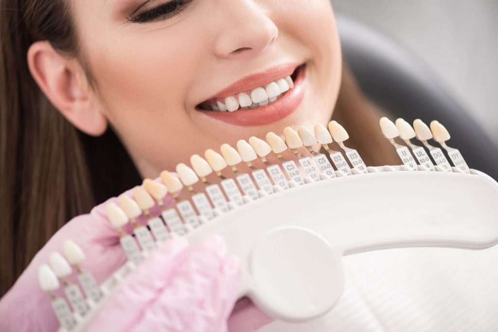 Teeth Whitening Or Veneers – Which Is The Right Choice For You?