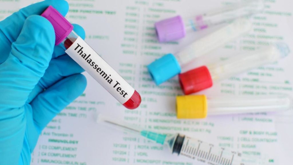 Thalassemia- All You Want To Know About It